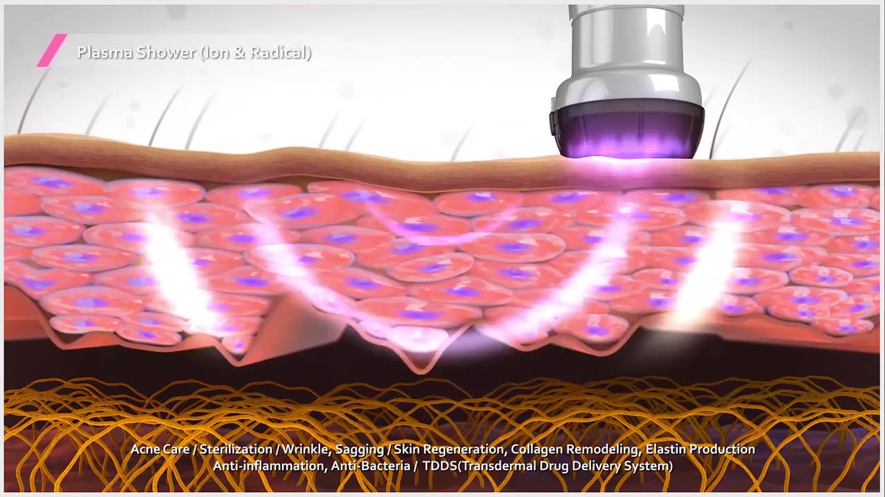 Cold plazma аппарат. плазменная энергия. как выглядит холодная плазма. горение плазмы. плазменная форма жизни.