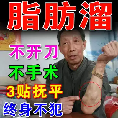 Fat retention anti-tumor cream removal artifact eliminates hard lump powder, multiple cacters fat bag retention subcutaneous fiber in the capsule