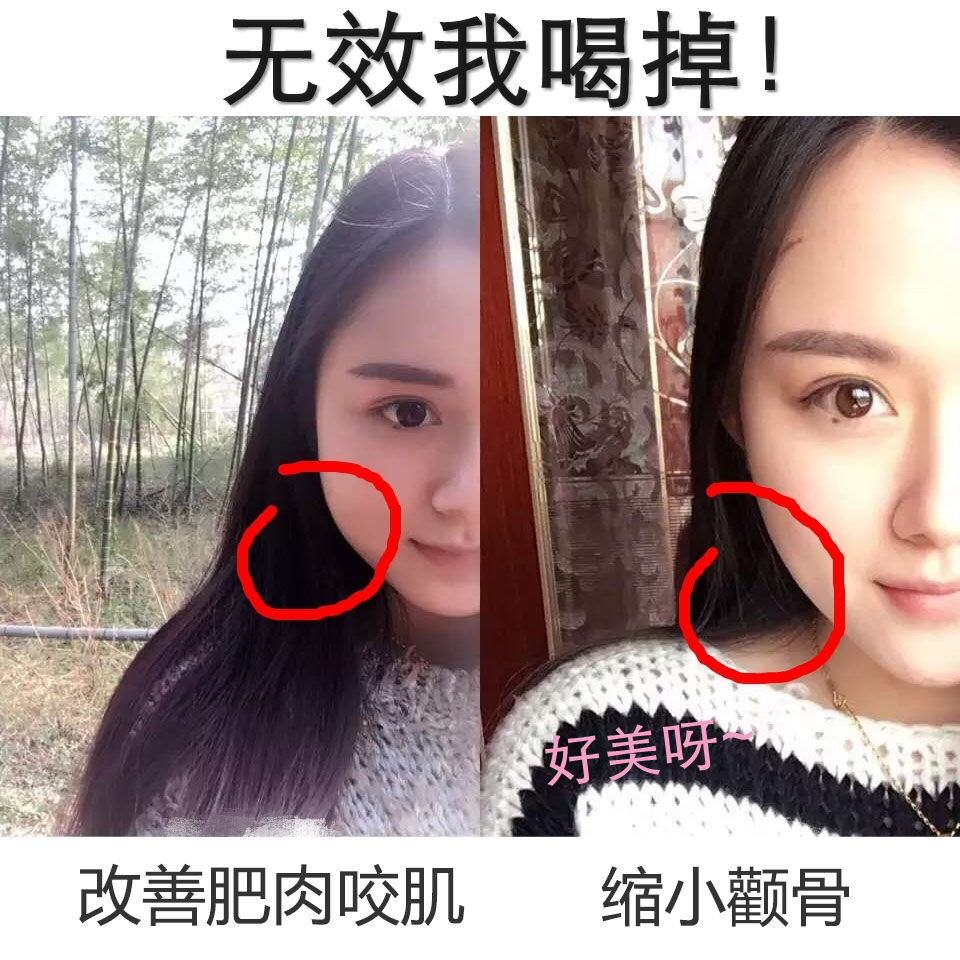 q ufine improves cheekbone small face shrinkage biting face under the jaw and fine fine fine fine fine