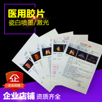 B5 16K A4 porcelain white laser printing film)) B super color ultrasound laser film)Double-sided printing porcelain white film