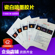 Hospital film B-ultrasound printing paper porcelain white inkjet translucent laser gastrointestinal endoscopy four-dimensional dry color ultrasound film