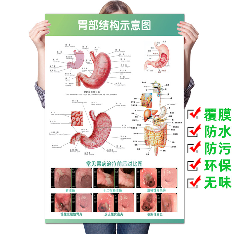 胃部結構醫學掛圖 人體胃部解剖圖適用醫院腸胃疾病宣傳