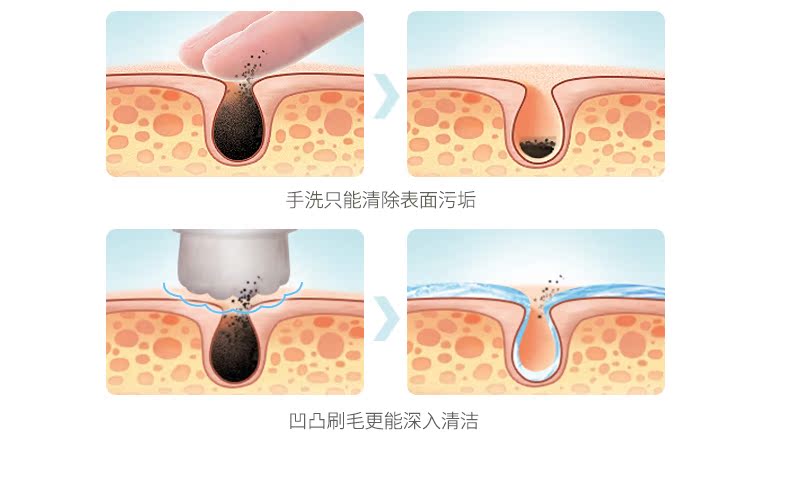 美克斯/MKS洁面仪NV8268原装刷头