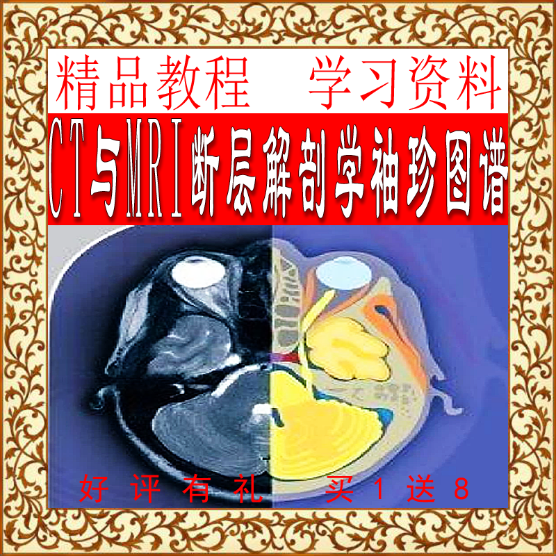 CT and MRI tomographic anatomy pocket atlas volume one head and neck biomedical high-tech scientific slices