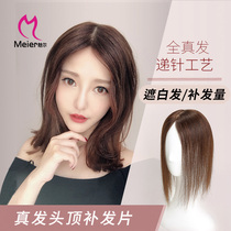 Pure hand-handed needle real hair head hair patch Female hair rare simulation scalp cover white hair hair loss hair patch