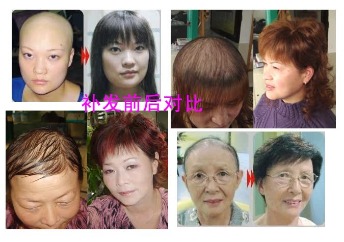 Extension mèches - Ref 223980 Image 15