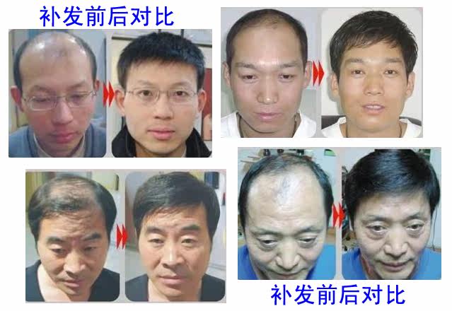 Extension mèches - Ref 225419 Image 10