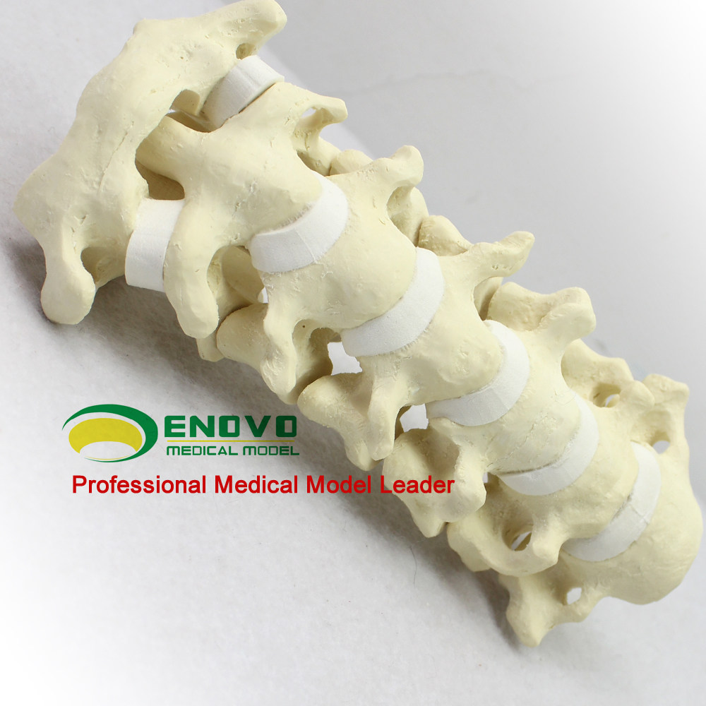 ENOVO Orthopaedic Sawbone bone teaching Human cervical spine model Medical orthopaedic surgery simulation bone