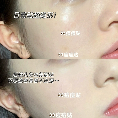 Ультра -тонкая невидимая макияж Оливюнг наклейка с прыщами Олива Абсорбционная гной, гной, прыщи, без отметок, 102 наклейки