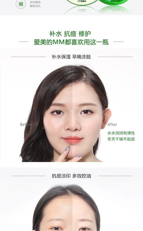 Aloe Repair Moisturising Gel 220g * 2 Kem chống mụn trứng cá Kem dưỡng ẩm Kem lô hội Gel lô hội kem dưỡng ẩm cho da thường