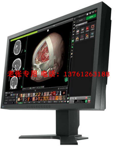 艺卓EIZO RadiForce GX560 MX317 RX1270 RX850：医疗液晶显示器的顶级选择，8MP解析力下的专业守护-企业级 ...
