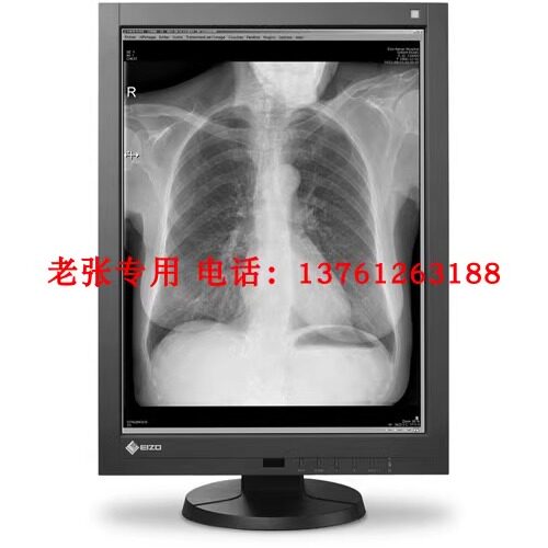 艺卓EIZO RadiForce RX660，医疗级显示有多专业？🔍-企业级显示器-淘宝好物网