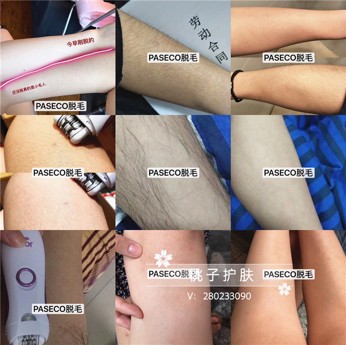 Special Clearance Korea Paseco Girl Electric Hair Removal Device To Take Off Leg Hair Armpit Hair Is Not Long Thick Is Not Long Dense