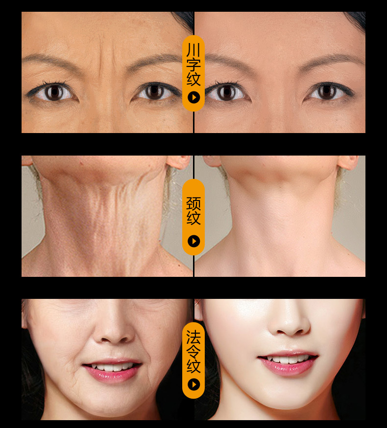 Thực phẩm cho da Liusheng Peptide Liquid Facial Serum Anti-nhăn Firming Desalination Wrinkle Head Rise serum trắng da mặt