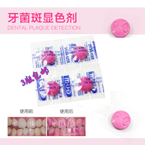 Dental plaque display agent GUM plaque stain coloring film color tablet 4 pieces of plaque indicator