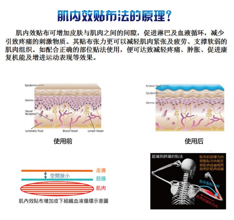 Protection sport - Ref 584122 Image 9