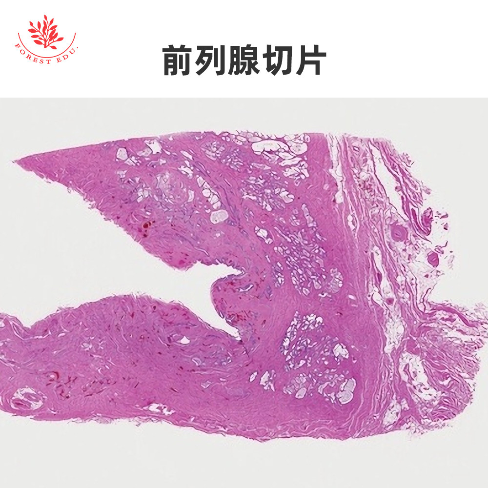 动物生殖器官正常组织玻片睾丸切片附睾切片前列腺切片人精虫涂片