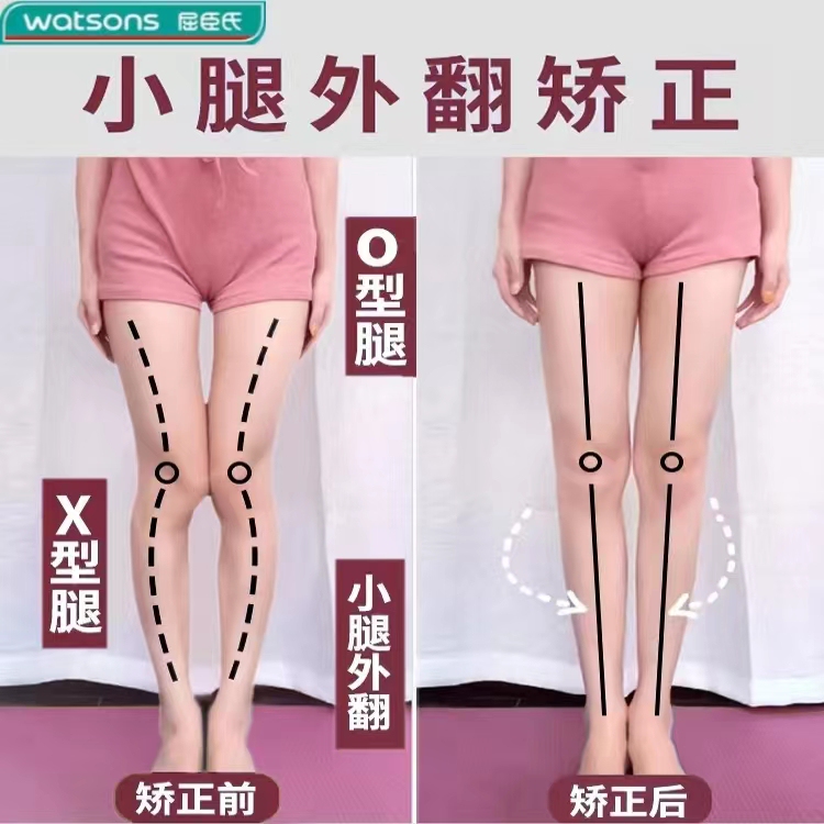 Adult Straight Leg Correction Insoles for O-Shaped/X-Shaped Legs, Calf Valgus Correction, Flat Arch Support Pads to Prevent Shoe Sole Wear