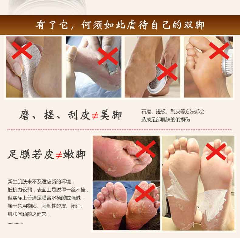 Anti 西 早 护 足 霜 足 裂 膏 Kem chống nứt chân chống ẩm tẩy tế bào chết chân