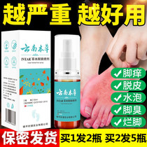 Yunnan herbal beriberi spray foot itching peeling antipruritic cream feet smelly sweat feet feet rotten bacteriostatic Buster buy 1 send 1