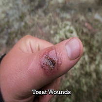 (Survival Equipment Supermarket) American Topical Triple Antibiotic Ointment Survival Maniac 0 5g per tablet