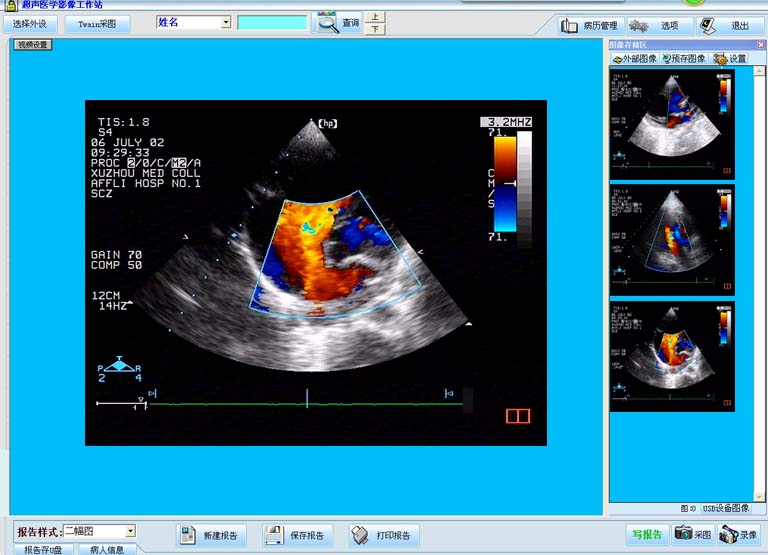 B ultrasound, color ultrasound imaging system, ultrasound imaging workstation