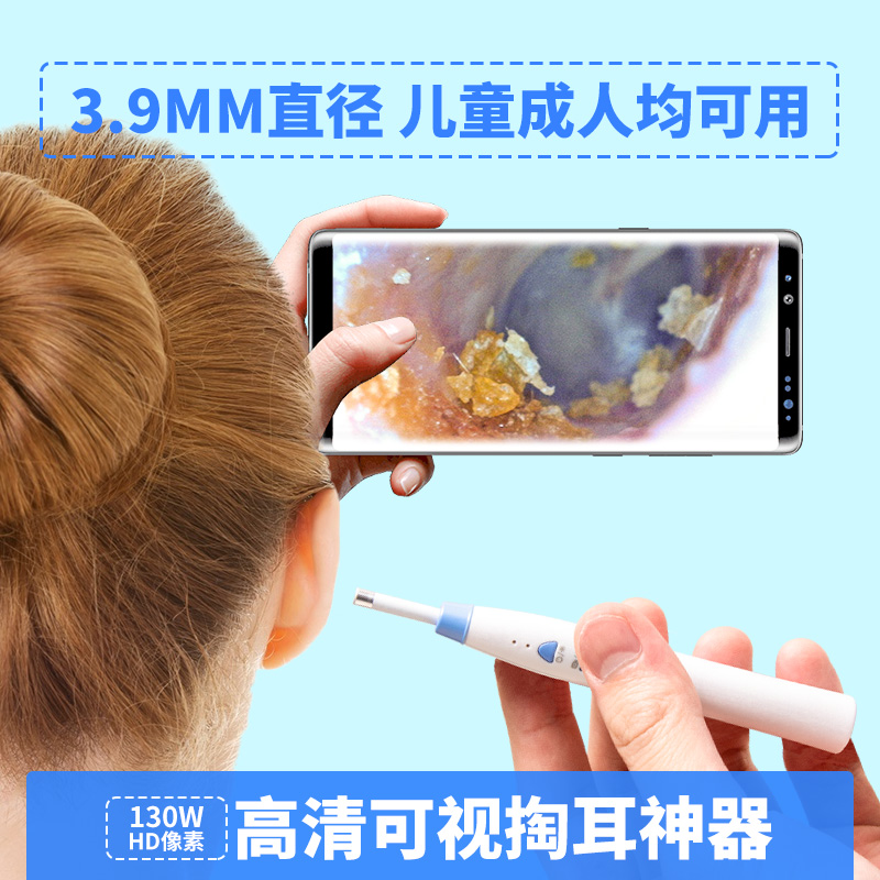 采耳可视挖耳勺真能看清耳道？揭秘高清内窥镜掏耳神器