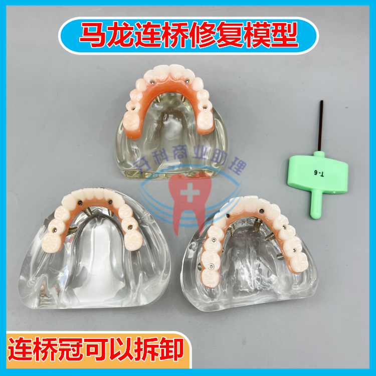 牙科口腔模型马龙连桥义齿修复种植牙齿仿真演示模拟教学医患沟通