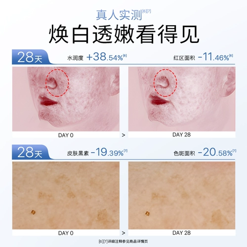 Белое молочко, осветляющий косметический комплект для ухода за кожей, удаление веснушек, устранение тусклости кожи, против морщин