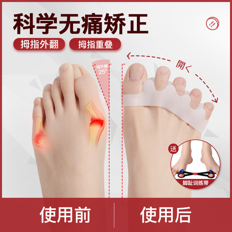Toe Straightener Female Large Footed thumb valgus straightener Improved correction can be worn with shoes male and female toe-toeners