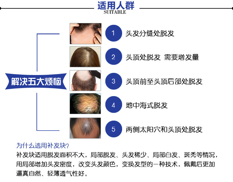 Extension mèches - Ref 224966 Image 9