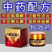 The Lone Musty Ringworm Pruritus Specialis Pruritus Lichen Tinea Pettiasis Cream