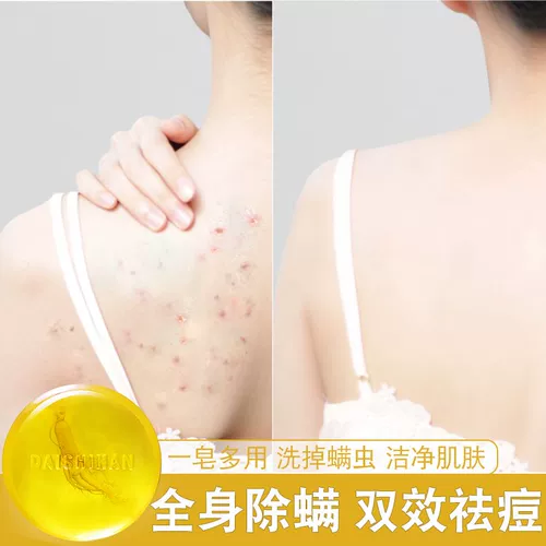 Мыло, очищающее молочко для умывания подходит для мужчин и женщин, против зуда, скрывает прыщи, контроль жирного блеска