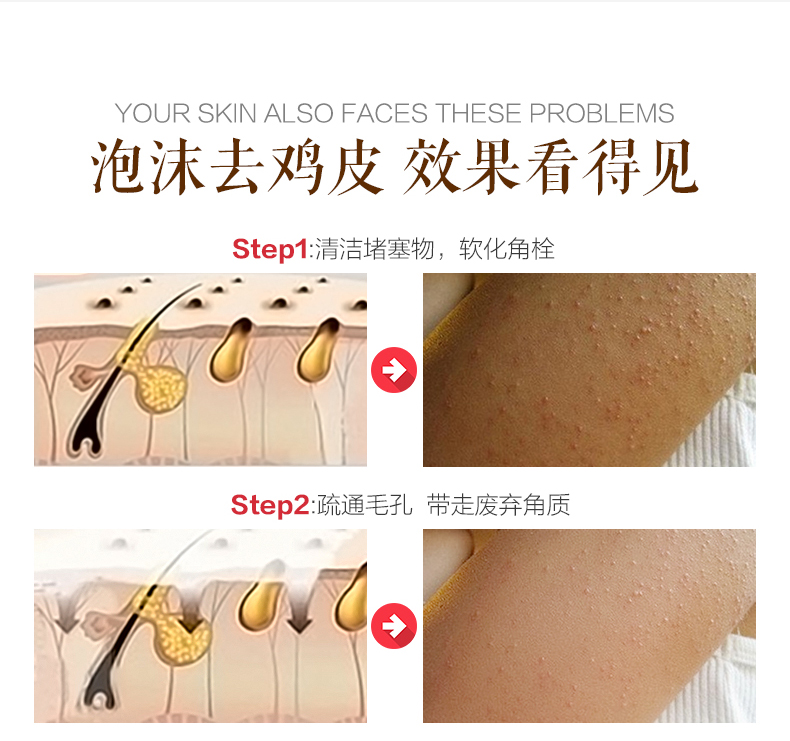 Dora Duo đi đến da gà handmade cơ thể xà phòng dịu dàng và mịn màng để da gà nang tóc sừng mùi hương xà phòng chăm sóc cơ thể vaseline dưỡng thể trắng da