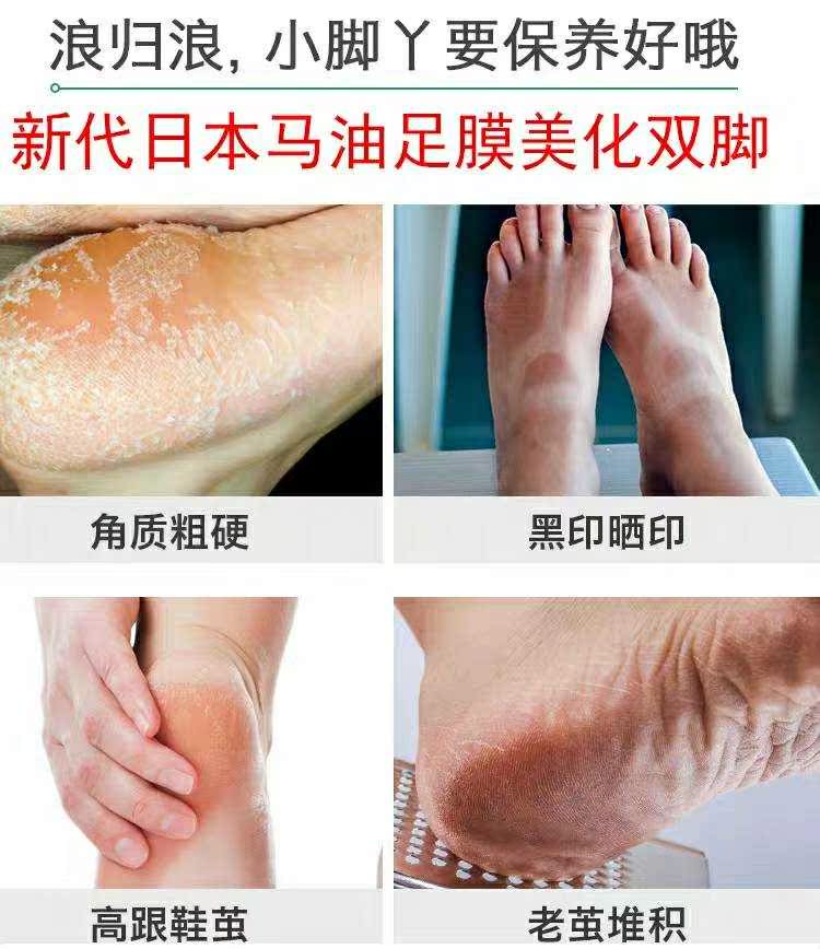 Mặt nạ dầu ngựa của Nhật Bản của Yun Yun đến da chết Ông già chân mềm gót chân khô nứt chân làm trắng dưỡng ẩm chăm sóc chân kem trị nứt gót