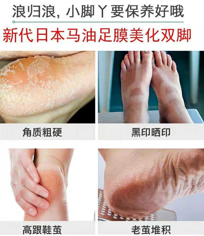 Mặt nạ dầu ngựa của Nhật Bản của Yun Yun đến da chết Ông già chân mềm gót chân khô nứt chân làm trắng dưỡng ẩm chăm sóc chân kem dưỡng ẩm tay chân