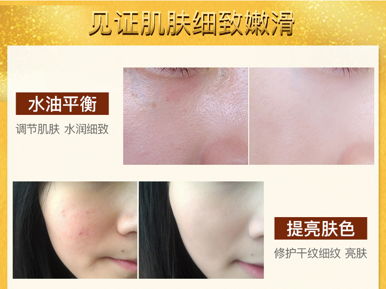 Ngôn ngữ Shi Xin thu nhỏ lỗ chân lông ốc sên vàng tinh chất rau má