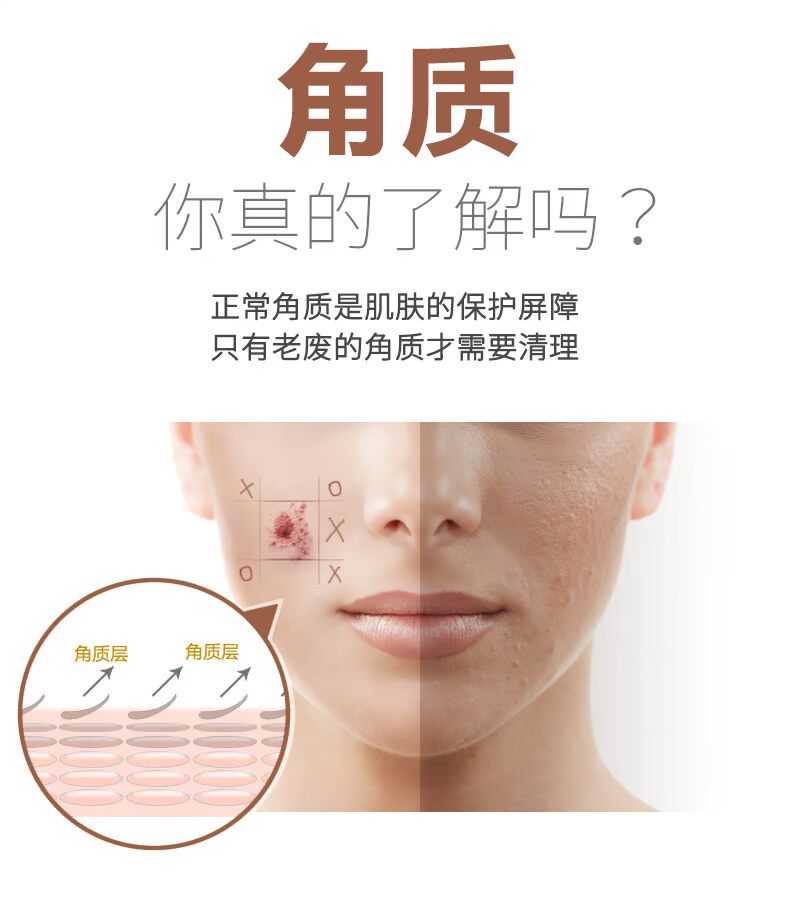 Ôi Shiman đi vào da chết da lộn nhẹ nhàng tẩy da chết làm sạch sâu mụn đầu đen mặt trên cơ thể đàn ông và phụ nữ tẩy tế bào chết ngọc trai
