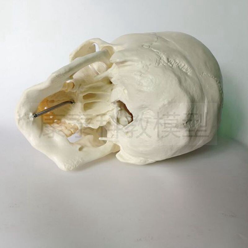 /