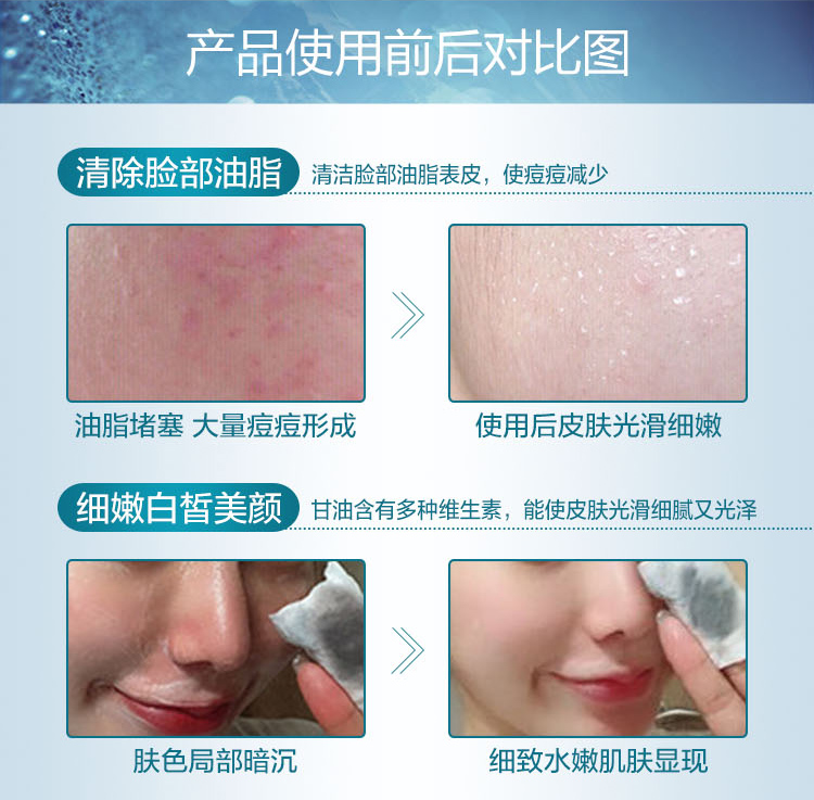 Authentic Purifying Rejuvenation Detox Cream Nữ Face Facial Beauty Salon Massage đặc biệt Kem làm sạch sâu lỗ chân lông kem massage mặt cho da dầu