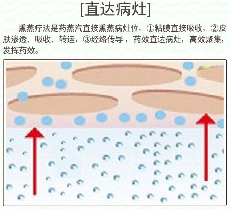 Cận thị, nhược thị, loạn thị, xông hơi thuốc bắc / phòng ngừa cải thiện thị lực / thuốc nhỏ mắt rửa mắt giảm mỏi thị lực - Thuốc nhỏ mắt