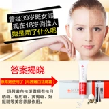 Отбеливающий увлажняющий крем для макияжа для осветления пигментных пятен, удаление веснушек, 30г