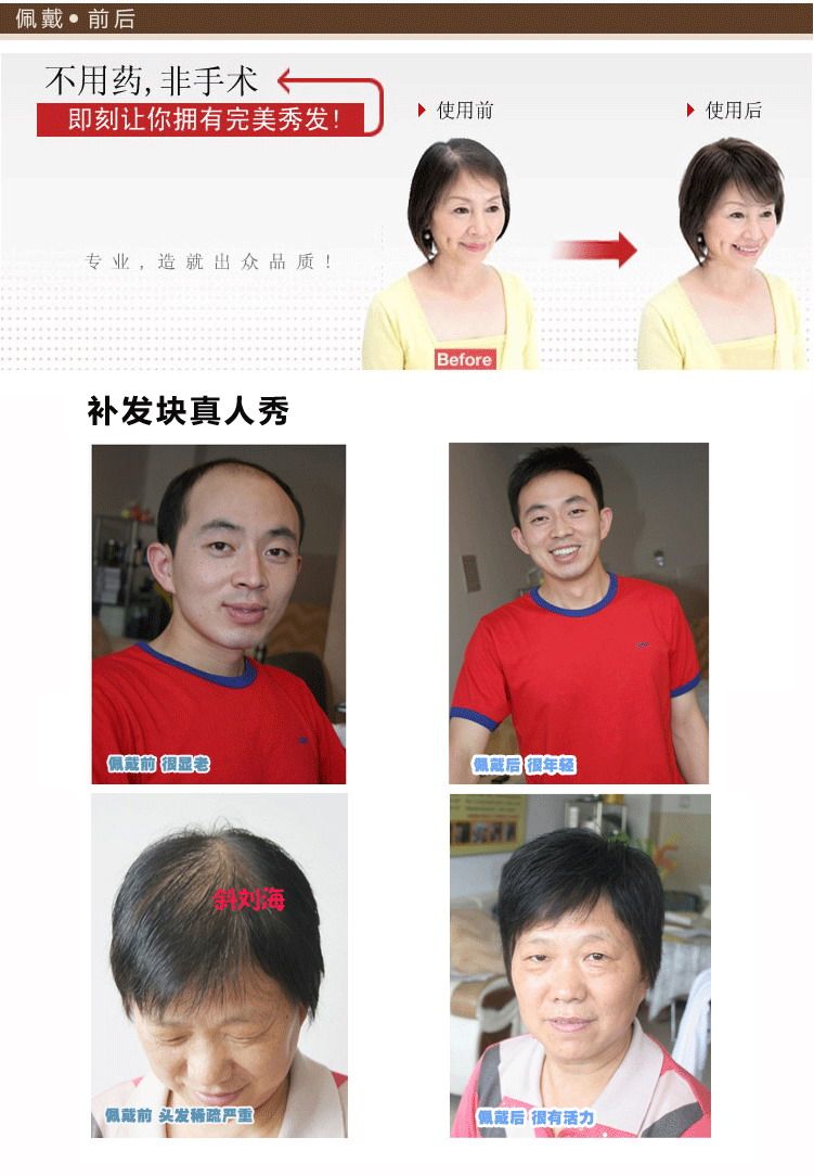 Extension cheveux - Ref 226323 Image 20