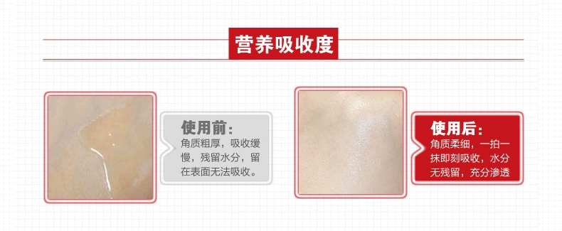 诗 白白 Gel tẩy tế bào chết cho mặt phụ nữ làm sạch sâu mụn đầu đen