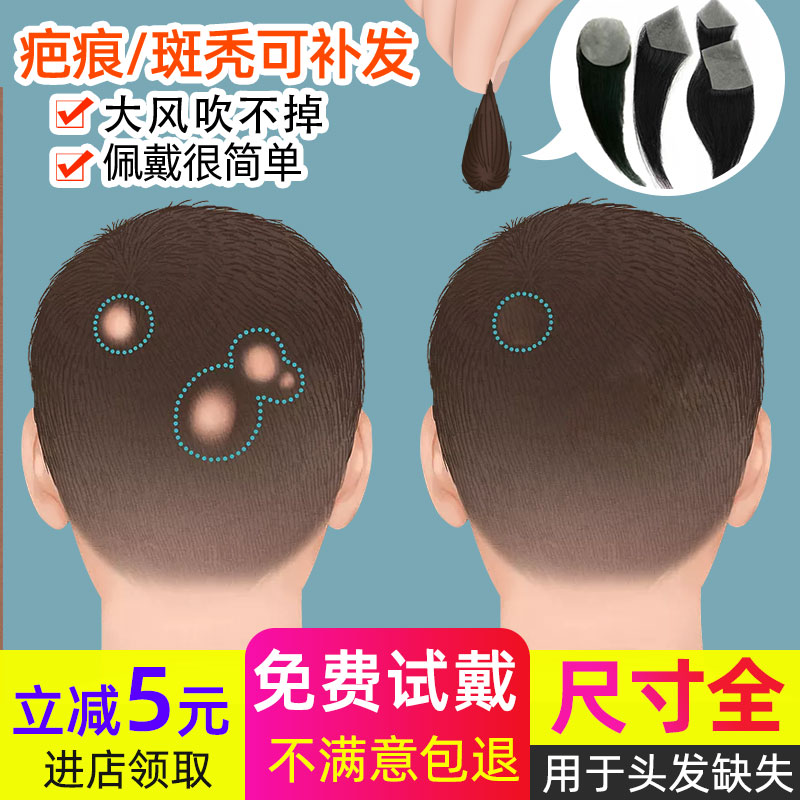 Scar Reissuance Patch Alopecia Areata Head Scars Head Invisible Wig Patch Traceless True Hair Silk Biological Scalp Men and Women