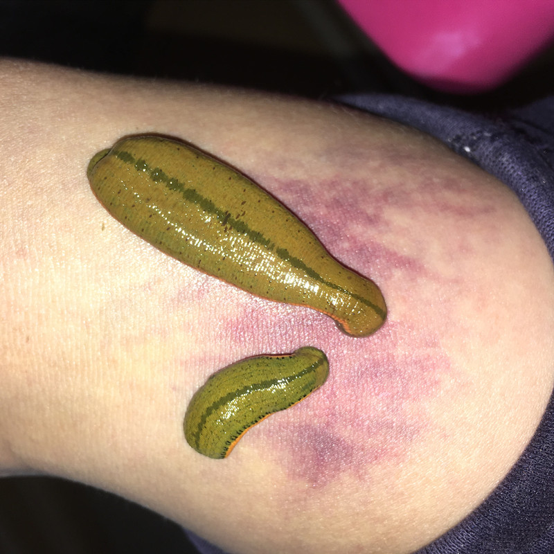 水蛭经营部