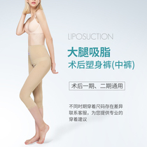 After skin sucking liposuction plastic pants thighs thighs buttocks abdominal sculpting liposuction shaping bottoming