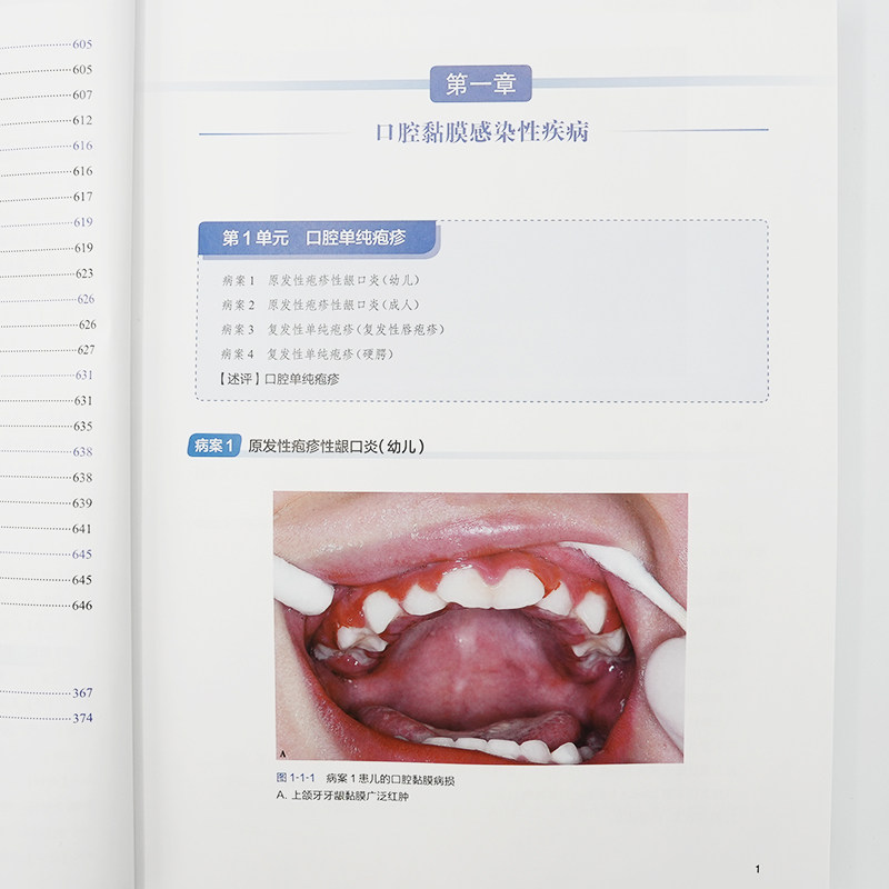 新口腔病理学 第3版 裁断済み）新口腔病理学 第3版
