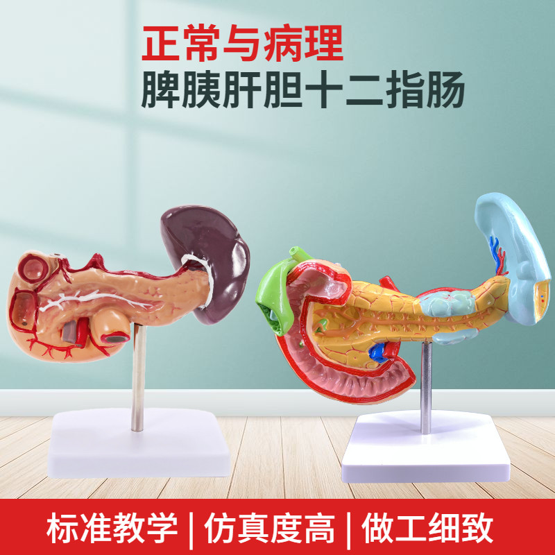 教学仿真病理胰脾肝胆十二指肠模型1:1自然大普通胰腺内脏标本