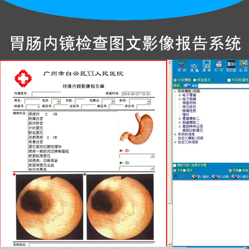 Gastroscope Endoscopy Enteroscopy Medical History Image Report System Film Collection Card Footboard Connecting Thread